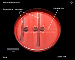 CAMP test for identification of streptococcus agalactiae (GBS)
